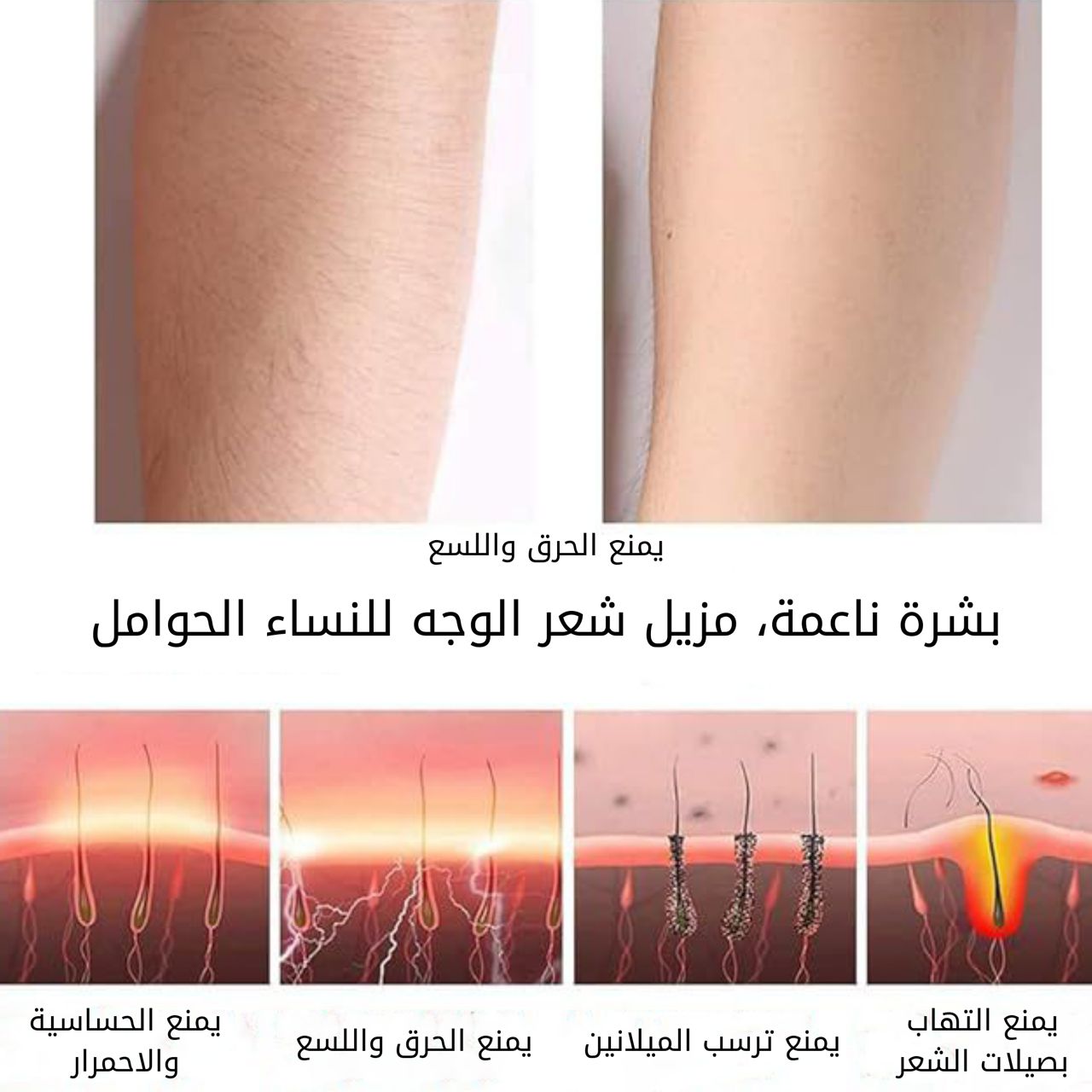 جهاز ازالة شعر الوجه